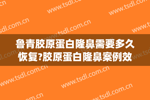 鲁青胶原蛋白隆鼻需要多久恢复?胶原蛋白隆鼻案例效果对比图_中南大学湘雅二医院