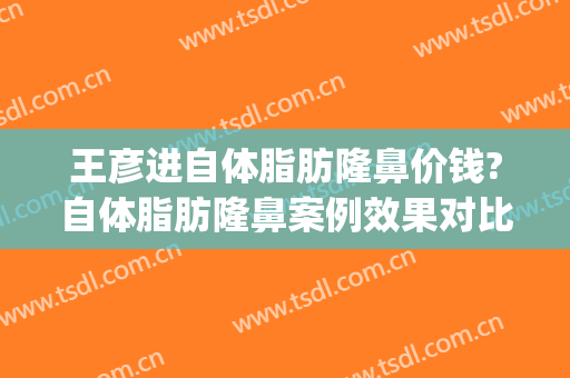 王彦进自体脂肪隆鼻价钱?自体脂肪隆鼻案例效果对比图_青岛大学附属医院
