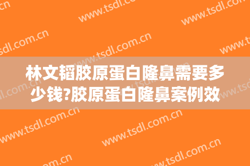 林文韬胶原蛋白隆鼻需要多少钱?胶原蛋白隆鼻案例效果对比图_重庆医科大学附属第一医院
