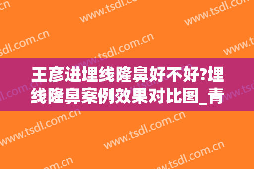 王彦进埋线隆鼻好不好?埋线隆鼻案例效果对比图_青岛大学附属医院