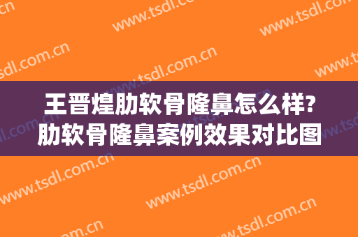 王晋煌肋软骨隆鼻怎么样?肋软骨隆鼻案例效果对比图_南方医科大学珠江医院