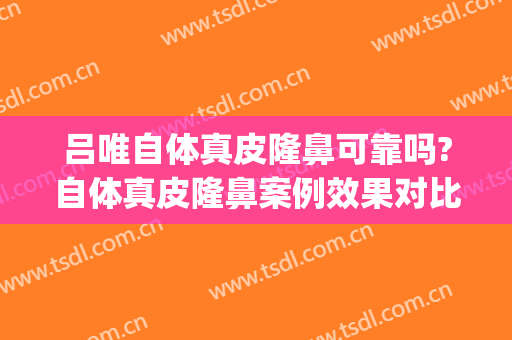 吕唯自体真皮隆鼻可靠吗?自体真皮隆鼻案例效果对比图_中国医学科学院整形外科医院