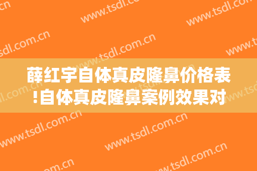 薛红宇自体真皮隆鼻价格表!自体真皮隆鼻案例效果对比图_北京大学第三医院