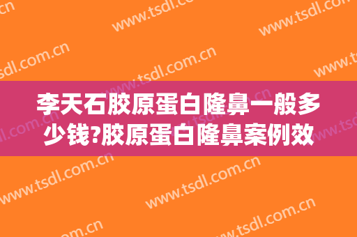 李天石胶原蛋白隆鼻一般多少钱?胶原蛋白隆鼻案例效果对比图_北京大学深圳医院