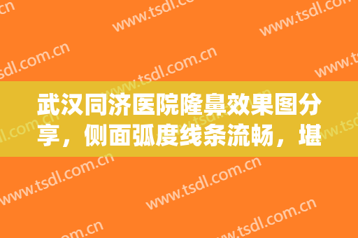 武汉同济医院隆鼻效果图分享，侧面弧度线条流畅，堪称一绝(武汉同济医院整鼻子怎么样)