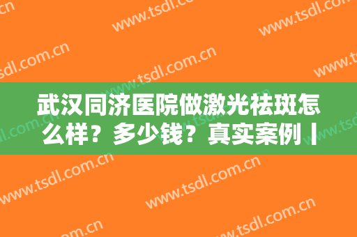 武汉同济医院做激光祛斑怎么样？多少钱？真实案例丨价格表一览