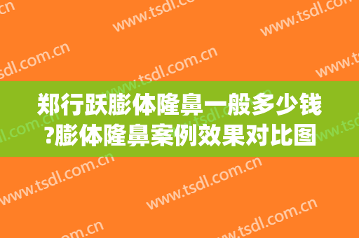郑行跃膨体隆鼻一般多少钱?膨体隆鼻案例效果对比图_好大夫工作室