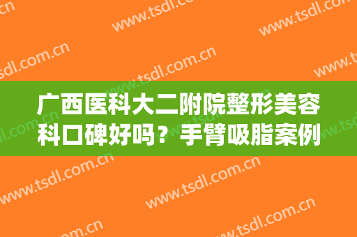 广西医科大二附院整形美容科口碑好吗？手臂吸脂案例图分享！(广西医科大二附院整形美容科电话)