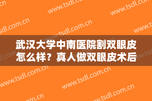 武汉大学中南医院割双眼皮怎么样？真人做双眼皮术后效果反馈！附价格表
