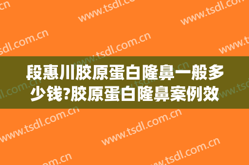 段惠川胶原蛋白隆鼻一般多少钱?胶原蛋白隆鼻案例效果对比图_上海交通大学医学院附属第九人民医院