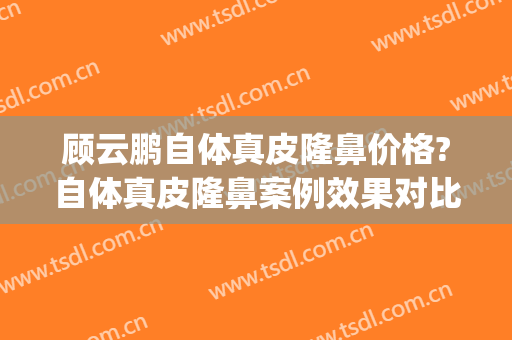 顾云鹏自体真皮隆鼻价格?自体真皮隆鼻案例效果对比图_中国医学科学院整形外科医院