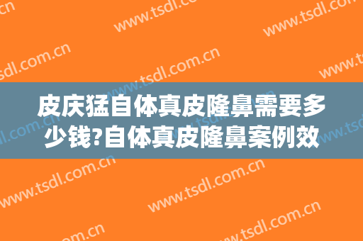 皮庆猛自体真皮隆鼻需要多少钱?自体真皮隆鼻案例效果对比图_上海交通大学医学院附属仁济医院