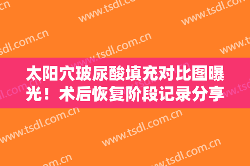 太阳穴玻尿酸填充对比图曝光！术后恢复阶段记录分享！