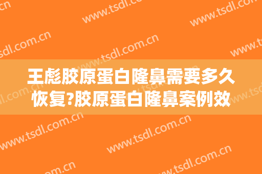 王彪胶原蛋白隆鼻需要多久恢复?胶原蛋白隆鼻案例效果对比图_福建医科大学附属第一医院