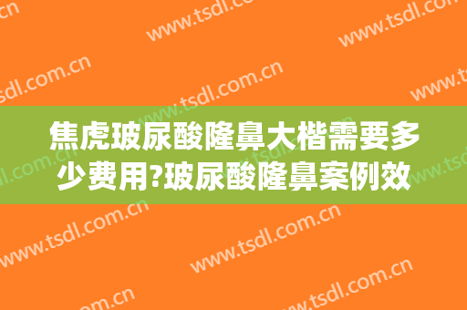 焦虎玻尿酸隆鼻大楷需要多少费用?玻尿酸隆鼻案例效果对比图_中国医学科学院整形外科医院