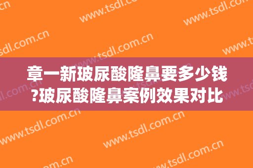 章一新玻尿酸隆鼻要多少钱?玻尿酸隆鼻案例效果对比图_上海交通大学医学院附属第九人民医院