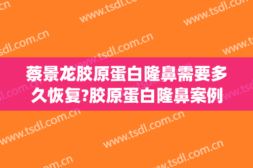 蔡景龙胶原蛋白隆鼻需要多久恢复?胶原蛋白隆鼻案例效果对比图_好大夫工作室