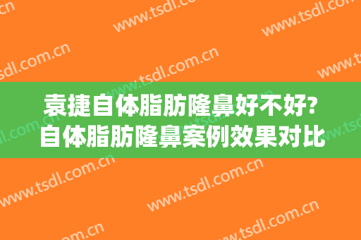 袁捷自体脂肪隆鼻好不好?自体脂肪隆鼻案例效果对比图_上海交通大学医学院附属第九人民医院
