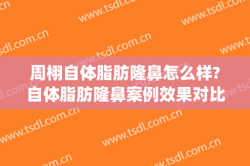 周栩自体脂肪隆鼻怎么样?自体脂肪隆鼻案例效果对比图_中国医学科学院整形外科医院