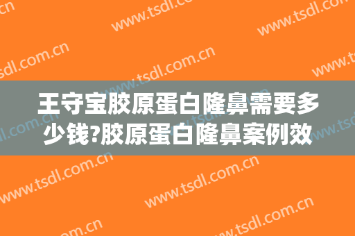 王守宝胶原蛋白隆鼻需要多少钱?胶原蛋白隆鼻案例效果对比图_上海交通大学医学院附属第九人民医院
