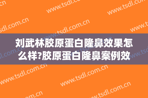 刘武林胶原蛋白隆鼻效果怎么样?胶原蛋白隆鼻案例效果对比图_苏州市立医院北区