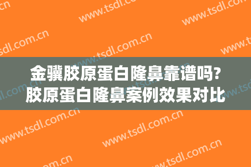 金骥胶原蛋白隆鼻靠谱吗?胶原蛋白隆鼻案例效果对比图_中国医学科学院整形外科医院