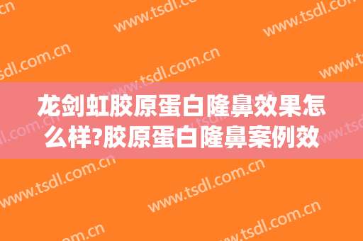 龙剑虹胶原蛋白隆鼻效果怎么样?胶原蛋白隆鼻案例效果对比图_中南大学湘雅医院