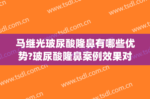 马继光玻尿酸隆鼻有哪些优势?玻尿酸隆鼻案例效果对比图_中国医学科学院整形外科医院