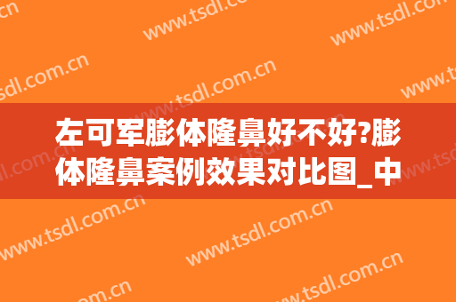 左可军膨体隆鼻好不好?膨体隆鼻案例效果对比图_中山大学附属第一医院