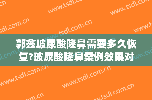 郭鑫玻尿酸隆鼻需要多久恢复?玻尿酸隆鼻案例效果对比图_中国医学科学院整形外科医院