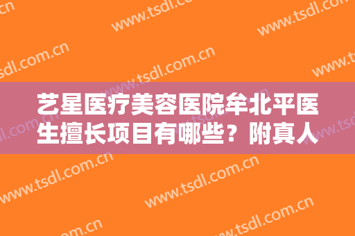 艺星医疗美容医院牟北平医生擅长项目有哪些？附真人胸部整形效果图！