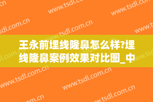 王永前埋线隆鼻怎么样?埋线隆鼻案例效果对比图_中国医学科学院整形外科医院
