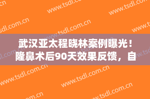武汉亚太程晓林案例曝光！隆鼻术后90天效果反馈，自然美观！(武汉亚太程晓林垫鼻子)