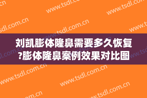 刘凯膨体隆鼻需要多久恢复?膨体隆鼻案例效果对比图_上海交通大学医学院附属第九人民医院