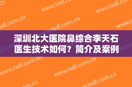 深圳北大医院鼻综合李天石医生技术如何？简介及案例揭秘，真材实料！