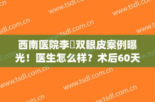 西南医院李喆双眼皮案例曝光！医生怎么样？术后60天后的效果反馈！(杨喆医生双眼皮手术)