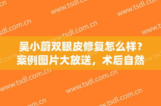 吴小蔚双眼皮修复怎么样？案例图片大放送，术后自然无痕~(人民医院吴小蔚双眼皮)
