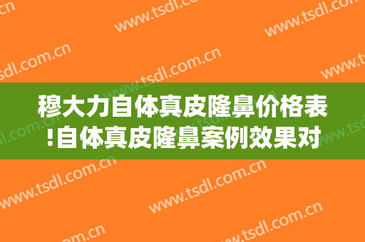 穆大力自体真皮隆鼻价格表!自体真皮隆鼻案例效果对比图_中国医学科学院整形外科医院