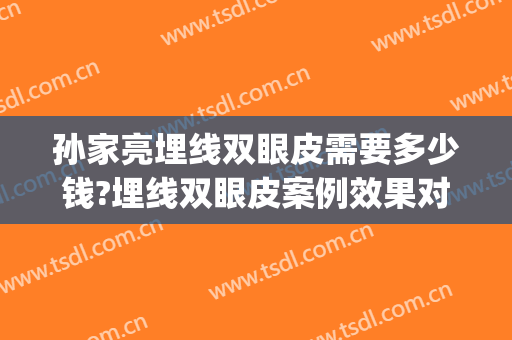 孙家亮埋线双眼皮需要多少钱?埋线双眼皮案例效果对比图_上海市奉贤区中心医院