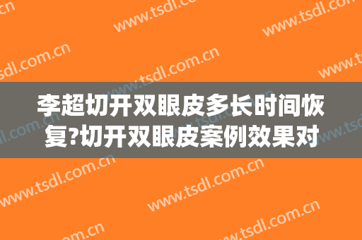 李超切开双眼皮多长时间恢复?切开双眼皮案例效果对比图_好大夫工作室
