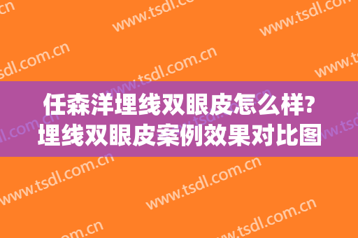 任森洋埋线双眼皮怎么样?埋线双眼皮案例效果对比图_宁波大学医学院附属医院