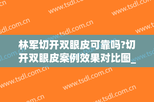 林军切开双眼皮可靠吗?切开双眼皮案例效果对比图_好大夫工作室(全切双眼皮手术效果)