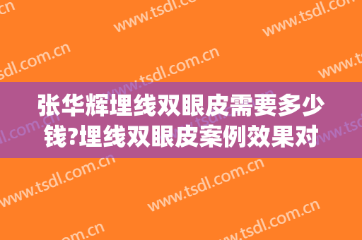张华辉埋线双眼皮需要多少钱?埋线双眼皮案例效果对比图_浙江医院(整形医院埋线双眼皮多少钱)