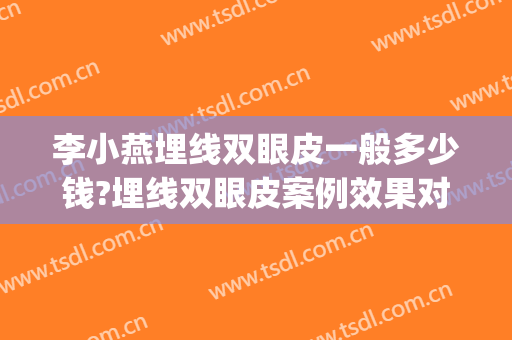 李小燕埋线双眼皮一般多少钱?埋线双眼皮案例效果对比图_十堰市太和医院