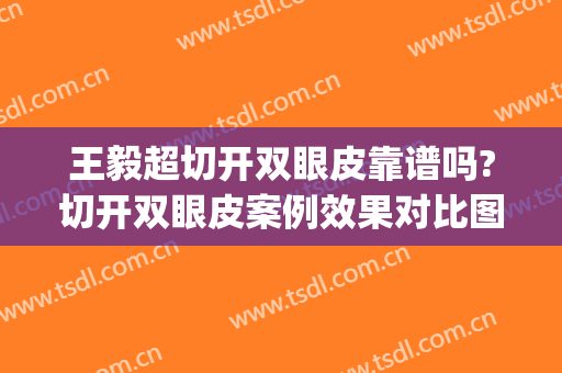 王毅超切开双眼皮靠谱吗?切开双眼皮案例效果对比图_北京大学第一医院
