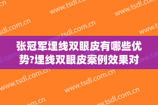 张冠军埋线双眼皮有哪些优势?埋线双眼皮案例效果对比图_济南市中心医院