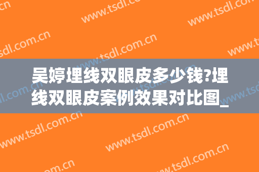 吴婷埋线双眼皮多少钱?埋线双眼皮案例效果对比图_四川省南充卫生学校附属医院