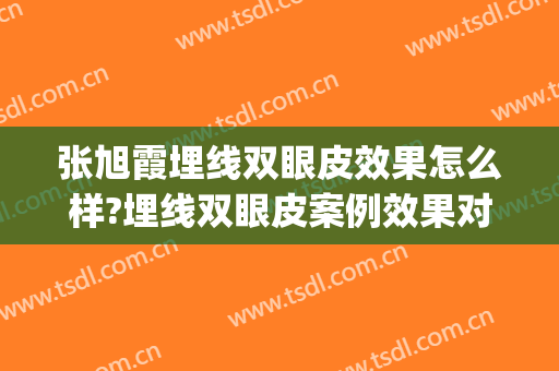 张旭霞埋线双眼皮效果怎么样?埋线双眼皮案例效果对比图_南方医科大学附属佛山医院