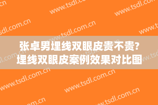 张卓男埋线双眼皮贵不贵?埋线双眼皮案例效果对比图_河北医科大学第二医院