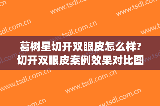 葛树星切开双眼皮怎么样?切开双眼皮案例效果对比图_蚌埠医学院第一附属医院